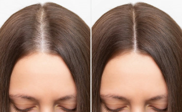 In congue magna sit nullam